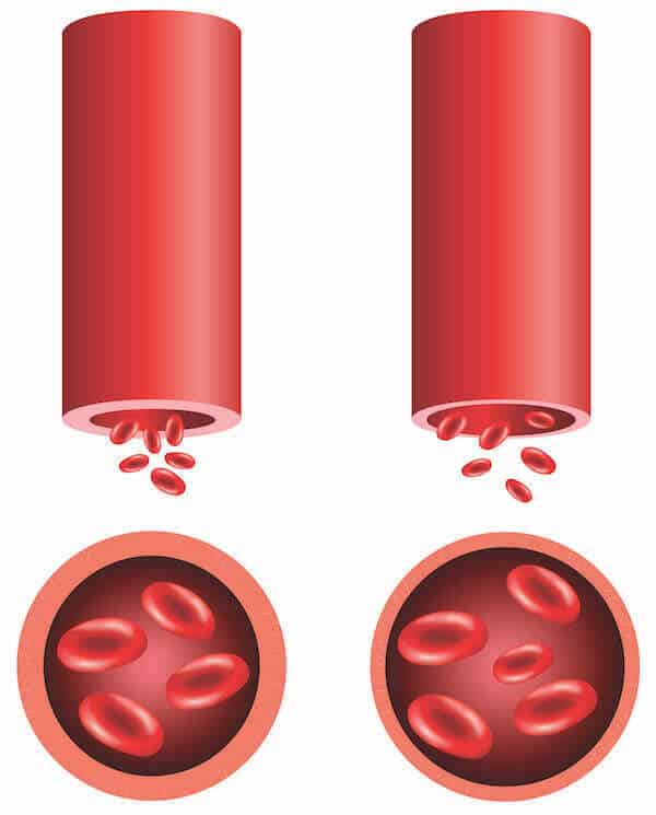 Vasodilation blood flow